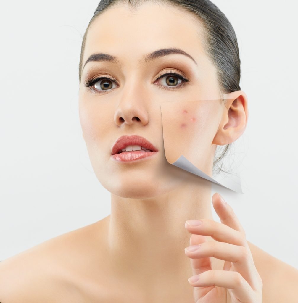 Benefits Of Using Facial Oils - Banish Acne